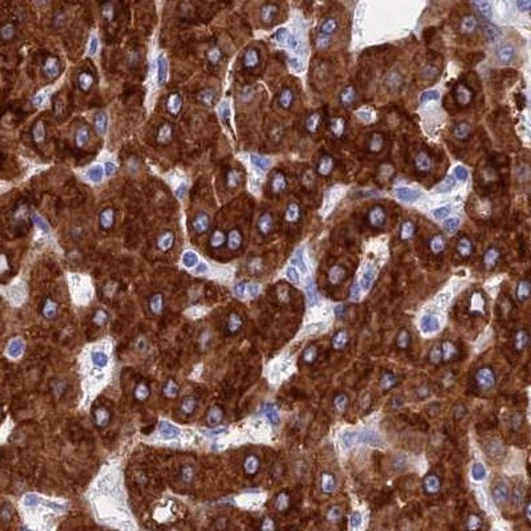 Immunohistochemistry: C5orf56 Antibody [NBP2-32023] - Staining of human liver shows strong cytoplasmic positivity in hepatocytes.