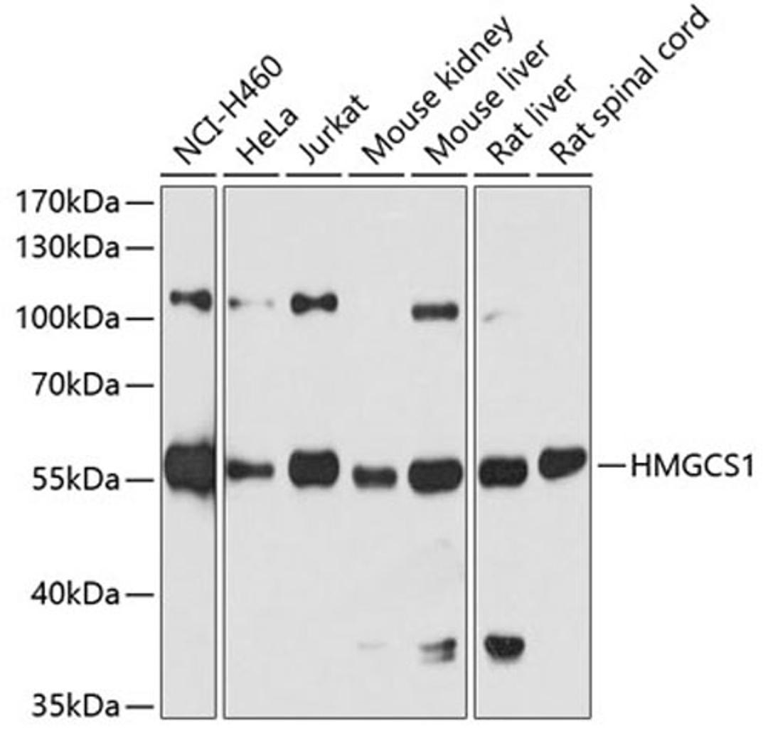 Western blot - HMGCS1 antibody (A3916)