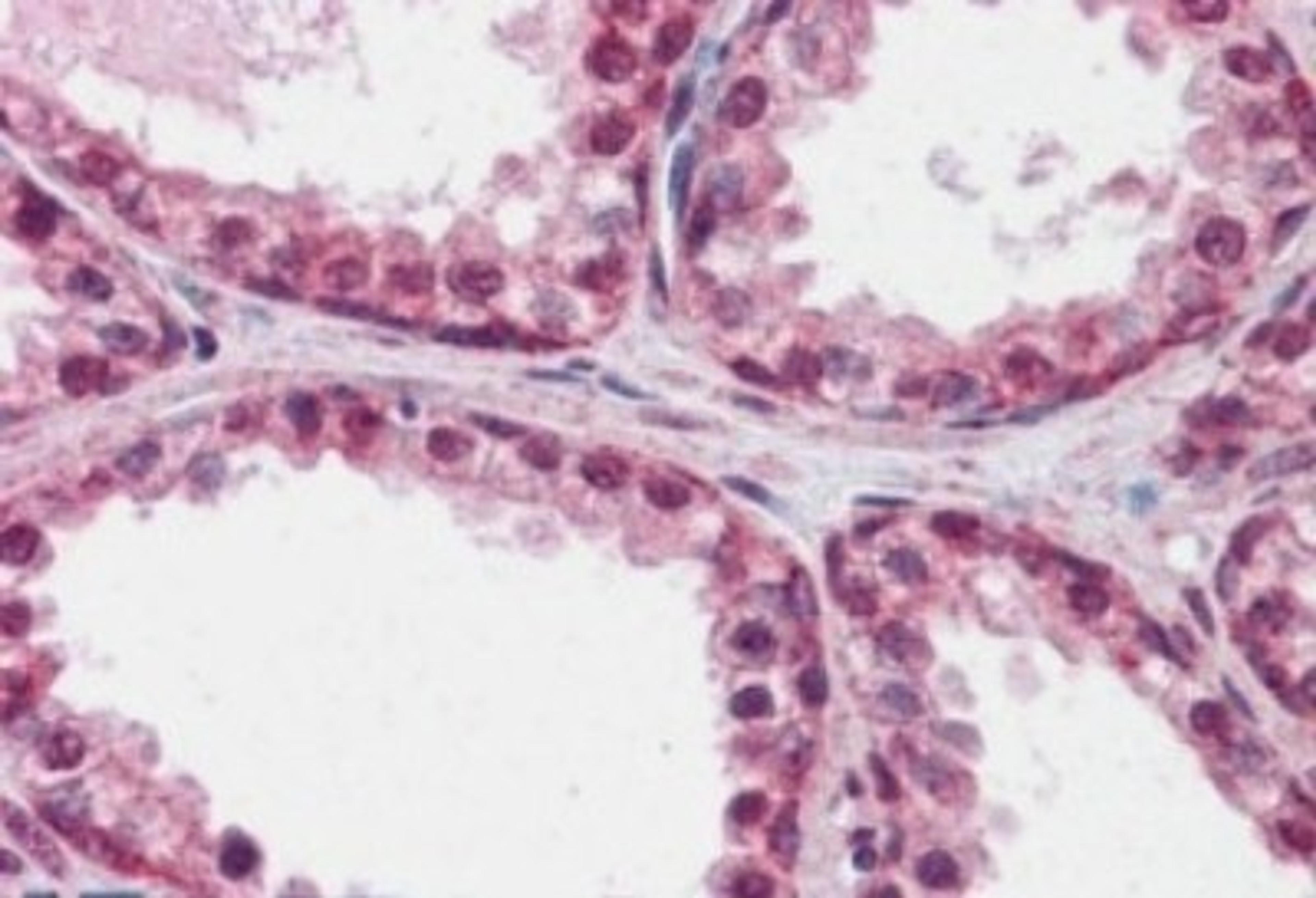 Immunohistochemistry-Paraffin: FOXP2 Antibody [NB100-55411] - (2.5ug/ml) staining of paraffin embedded Human Prostate. Steamed antigen retrieval with citrate buffer pH 6, AP-staining.