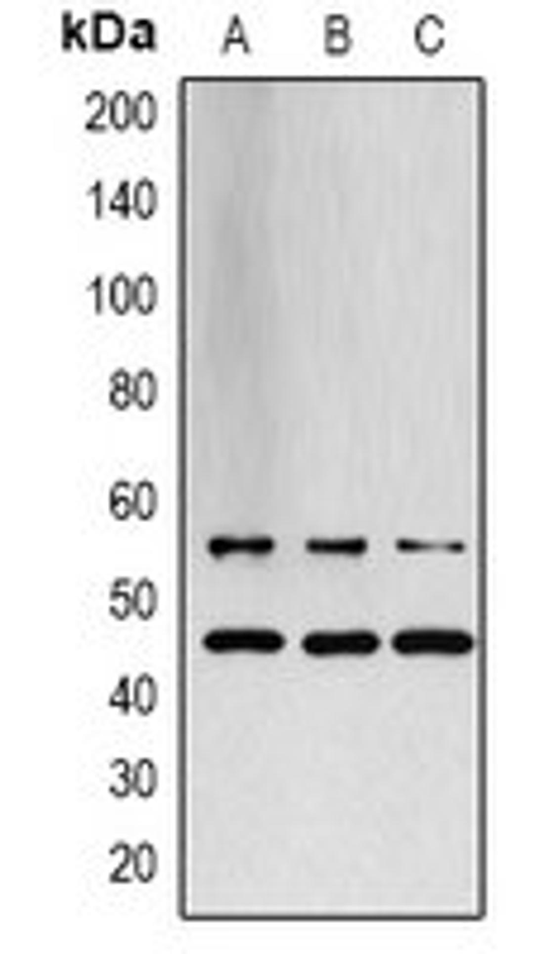 Western blot analysis of LOVO (Lane 1), PC12 (Lane 2), rat muscle (Lane 3) whole cell lysates using JNK1/2/3 antibody