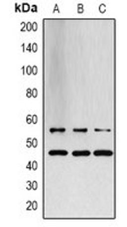 Western blot analysis of LOVO (Lane 1), PC12 (Lane 2), rat muscle (Lane 3) whole cell lysates using JNK1/2/3 antibody