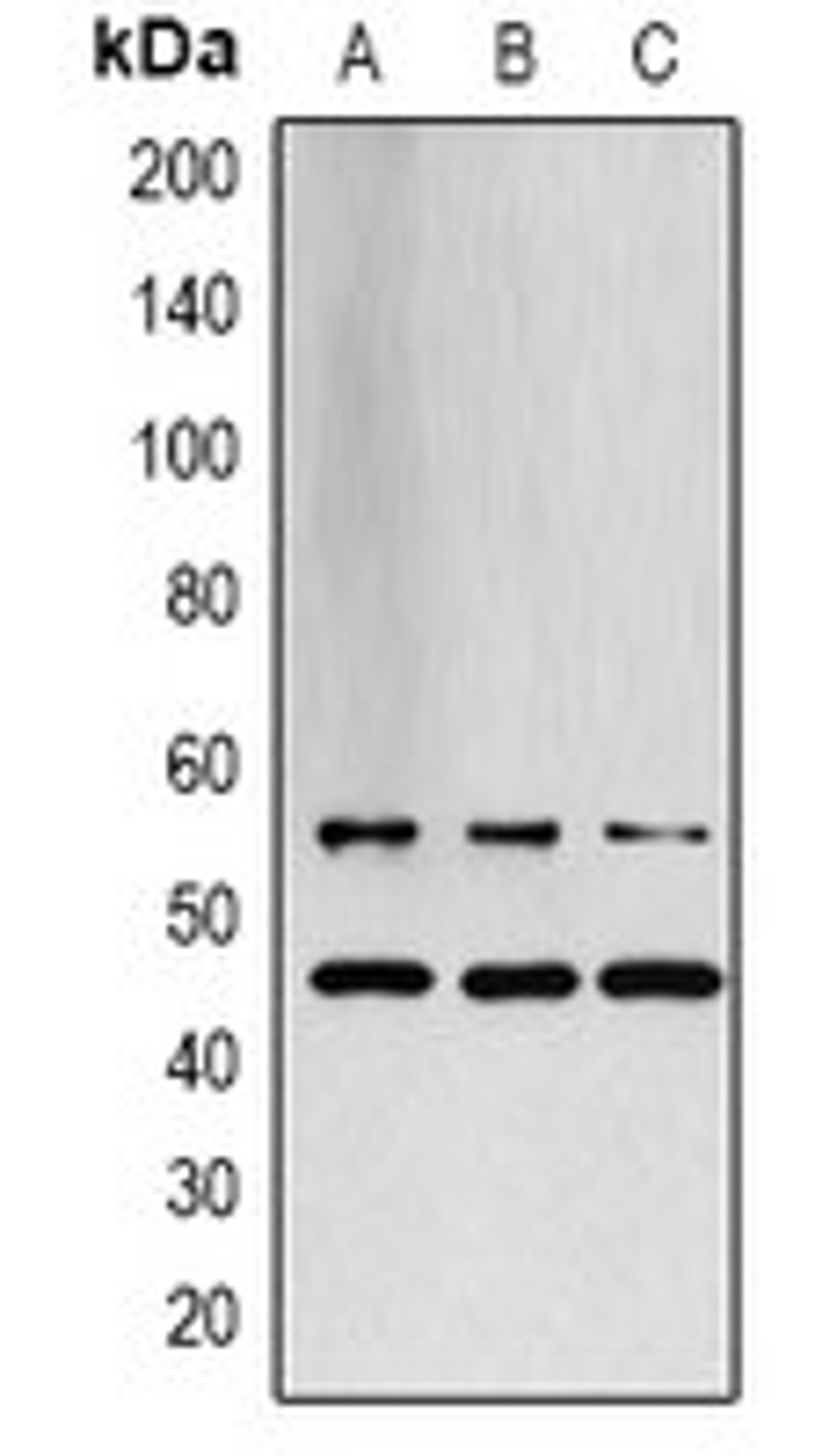 Western blot analysis of LOVO (Lane 1), PC12 (Lane 2), rat muscle (Lane 3) whole cell lysates using JNK1/2/3 antibody