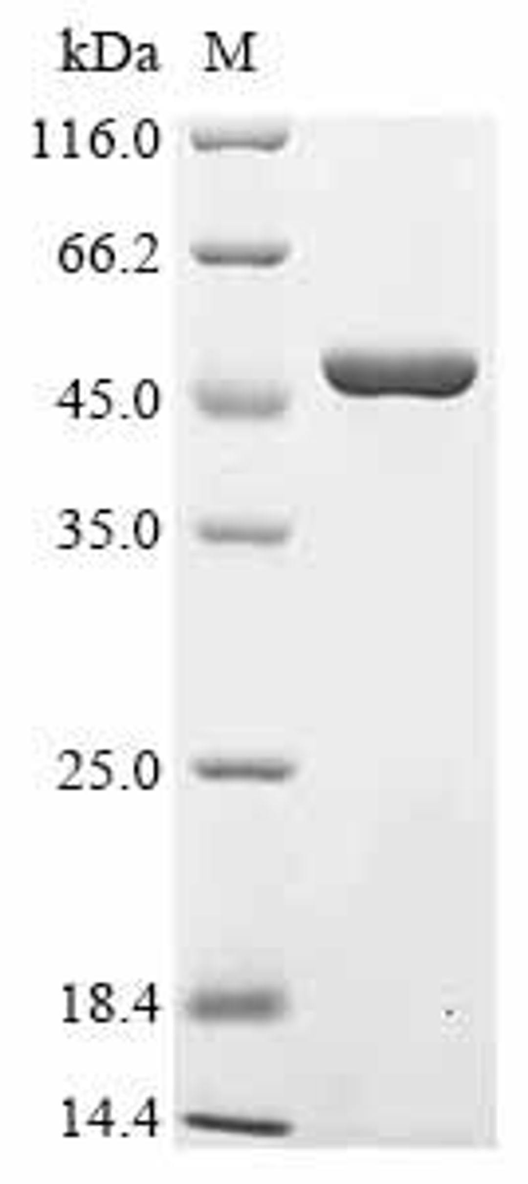 (Tris-Glycine gel) Discontinuous SDS-PAGE (reduced) with 5% enrichment gel and 15% separation gel.