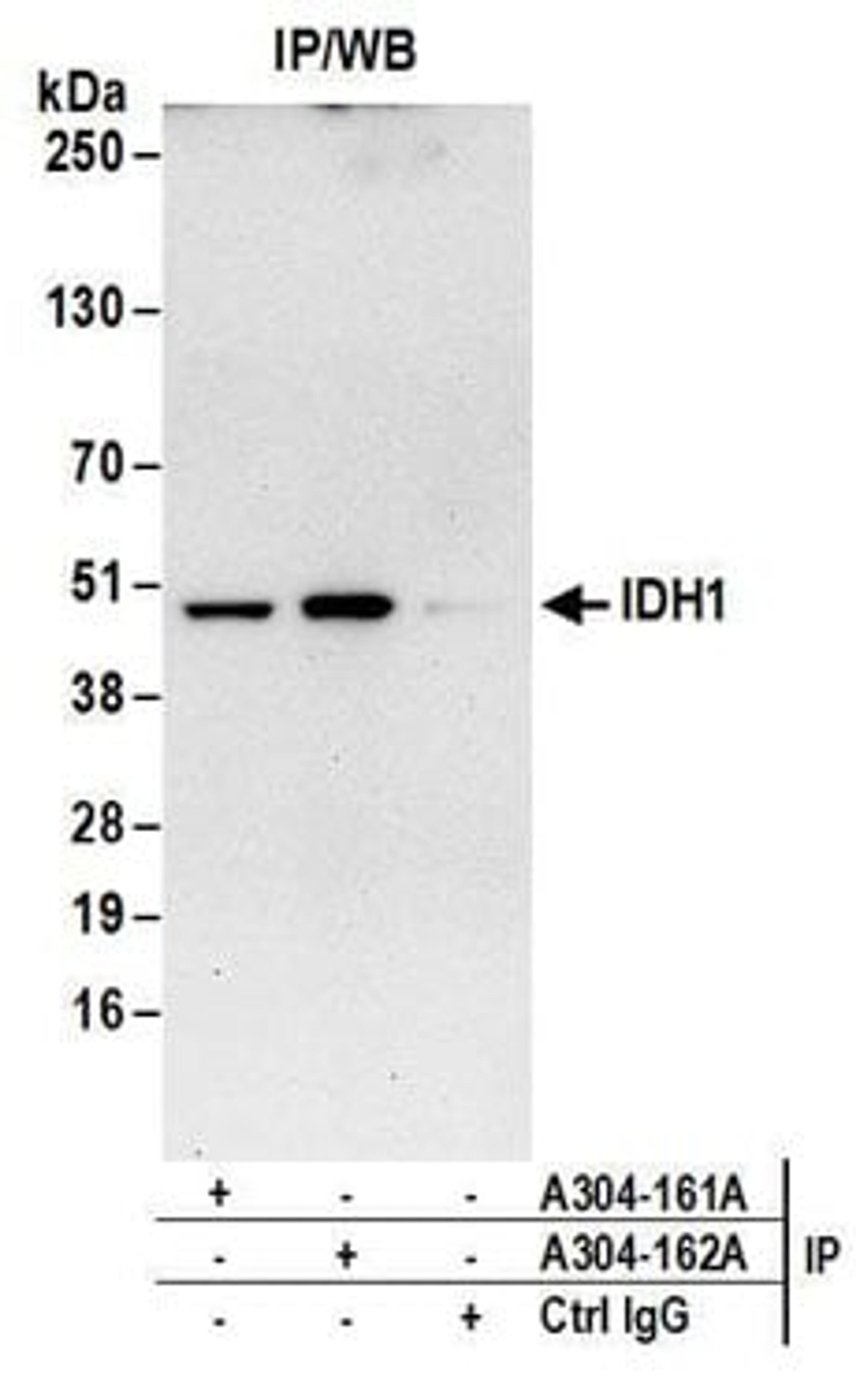 Detection of human IDH1 by western blot of immunoprecipitates.