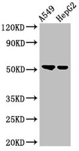 Western Blot. Positive WB detected in: A549 whole cell lysate, HepG2 whole cell lysate. All lanes: GCNT3 antibody at 3ug/ml. Secondary. Goat polyclonal to rabbit IgG at 1/50000 dilution. Predicted band size: 51 kDa. Observed band size: 51 kDa. 