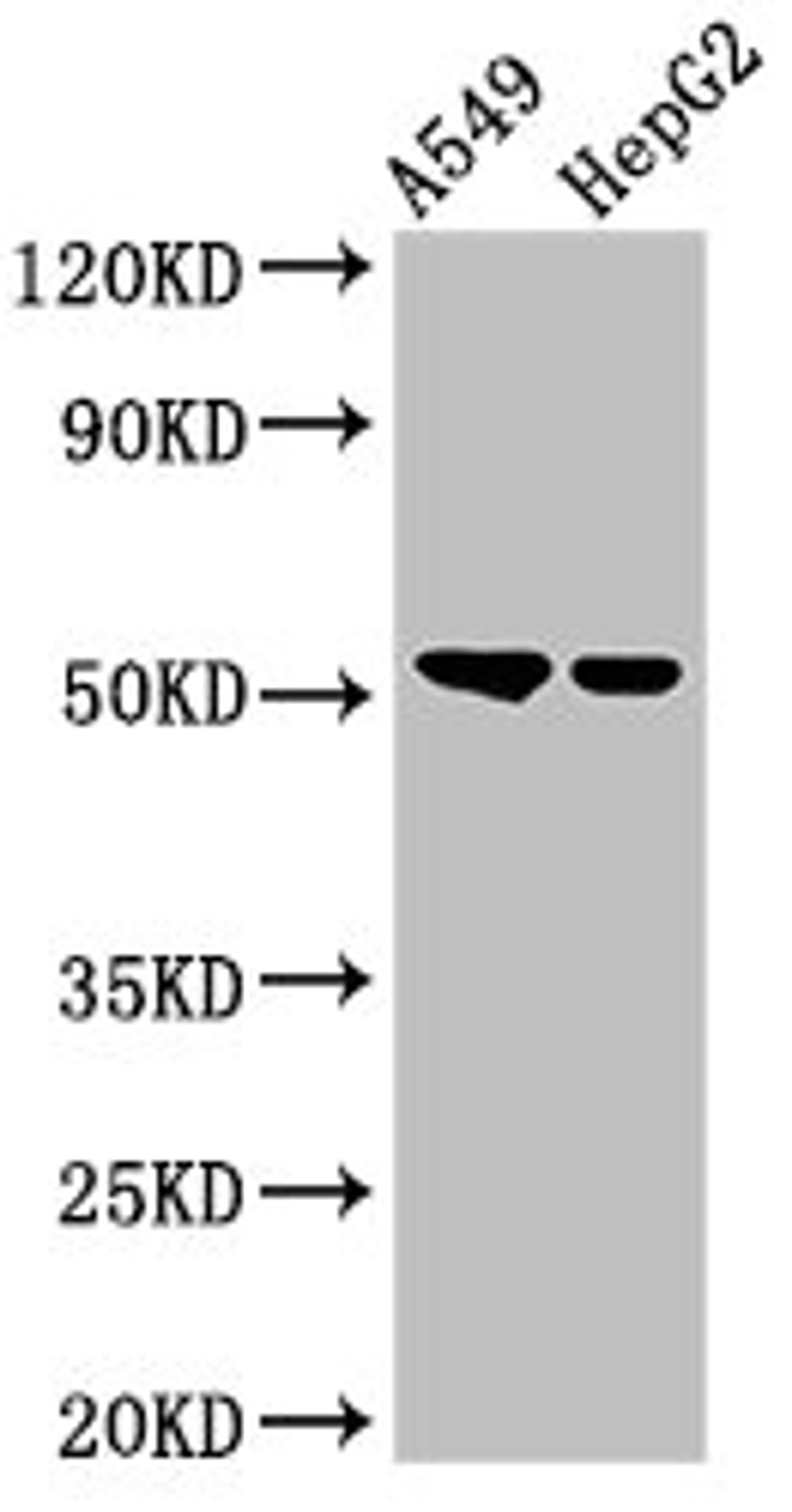Western Blot. Positive WB detected in: A549 whole cell lysate, HepG2 whole cell lysate. All lanes: GCNT3 antibody at 3ug/ml. Secondary. Goat polyclonal to rabbit IgG at 1/50000 dilution. Predicted band size: 51 kDa. Observed band size: 51 kDa. 