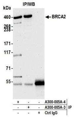 Detection of human BRCA2 by western blot of immunoprecipitates.