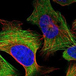 Immunocytochemistry/Immunofluorescence: NMT1 Antibody [NBP1-82547] - Staining of human cell line U-2 OS shows positivity in cytoplasm & cytoskeleton (actin filaments).