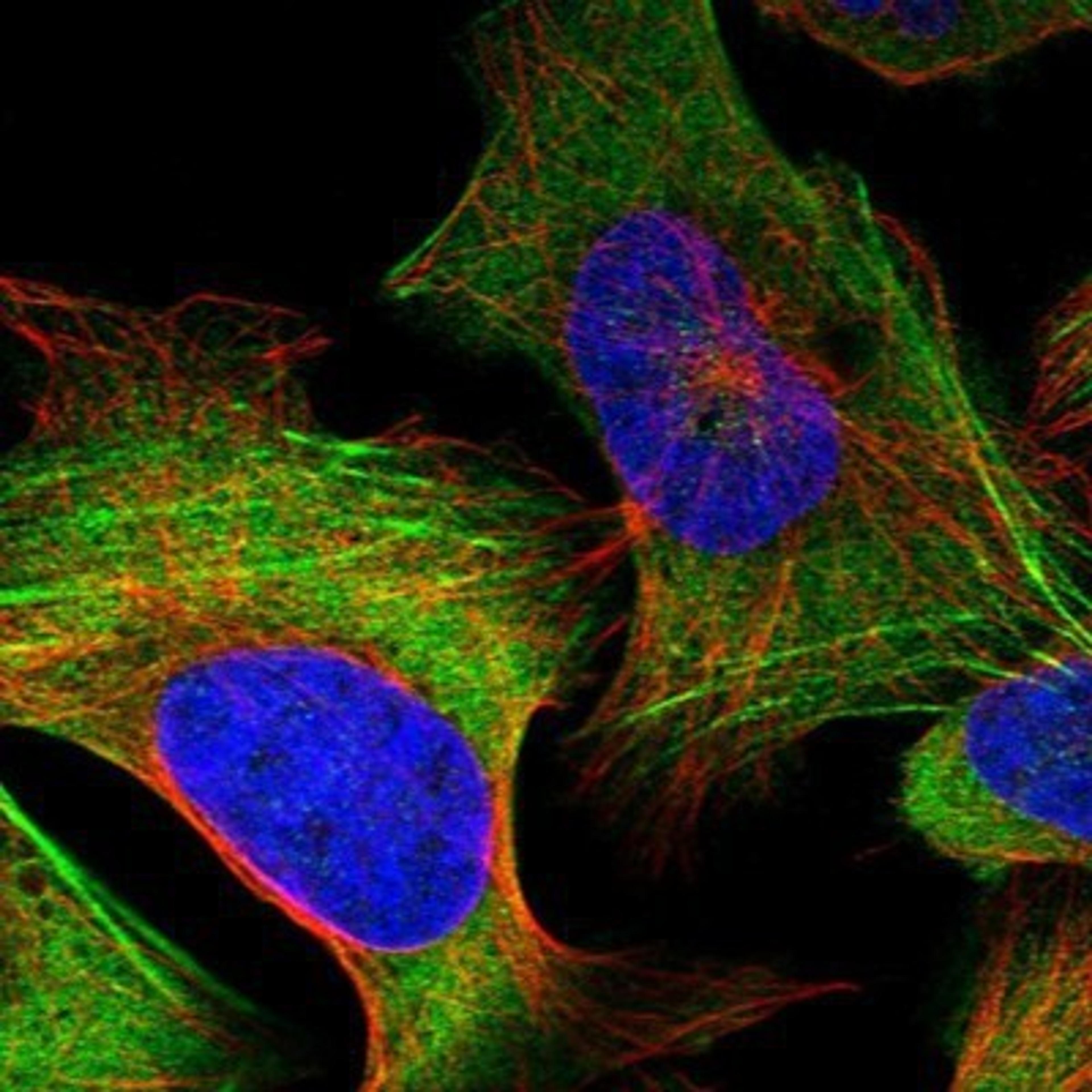 Immunocytochemistry/Immunofluorescence: NMT1 Antibody [NBP1-82547] - Staining of human cell line U-2 OS shows positivity in cytoplasm & cytoskeleton (actin filaments).