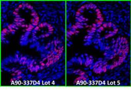 Detection of human p53 by immunofluorescence.