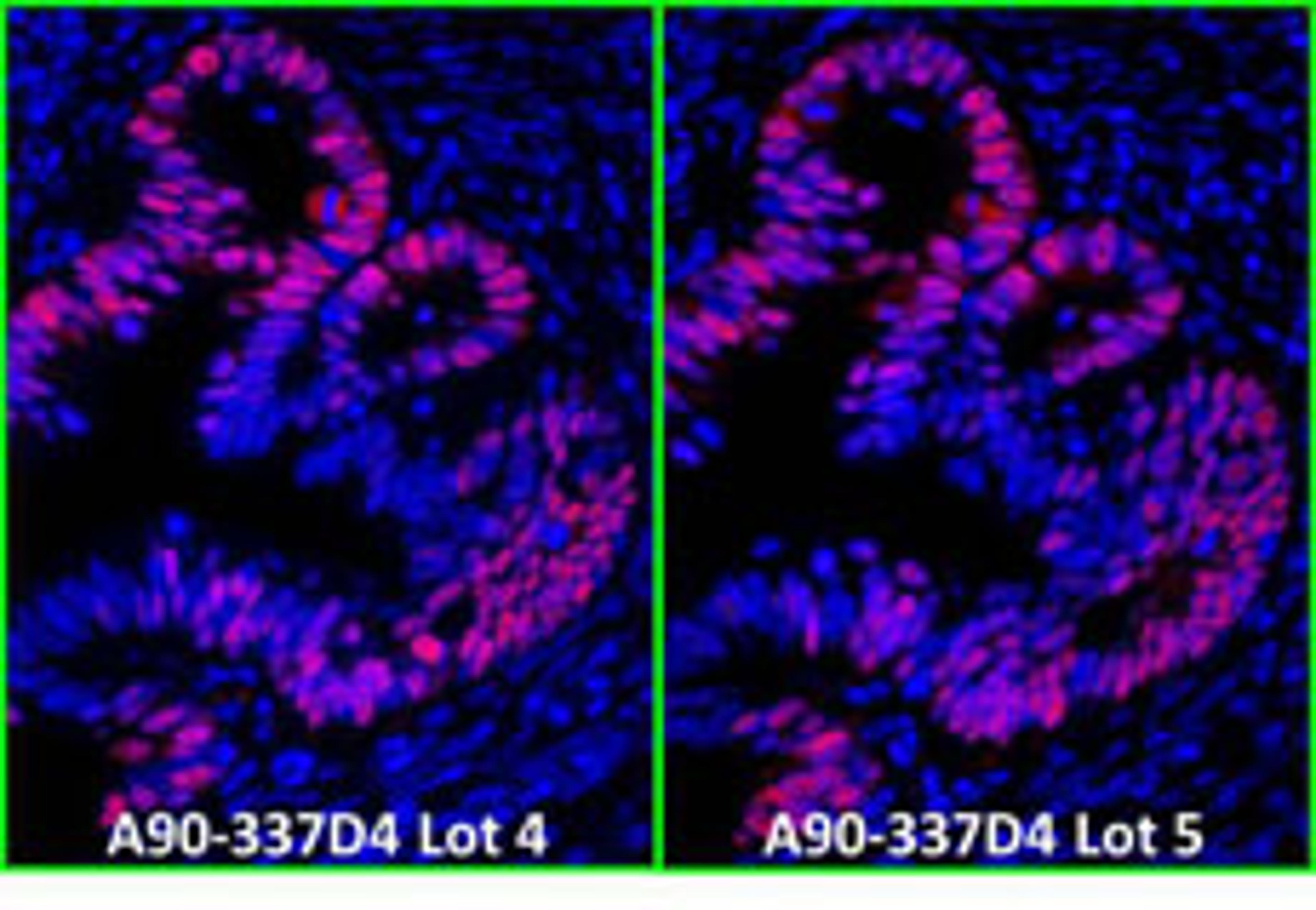 Detection of human p53 by immunofluorescence.