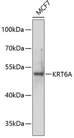 Western blot - KRT6A antibody (A7560)