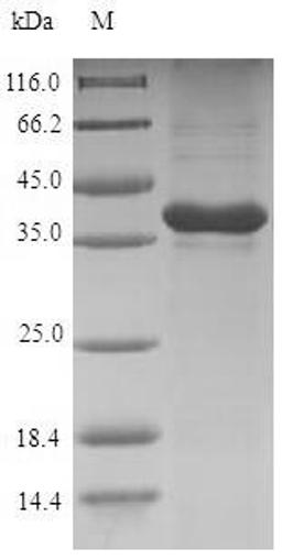 (Tris-Glycine gel) Discontinuous SDS-PAGE (reduced) with 5% enrichment gel and 15% separation gel.