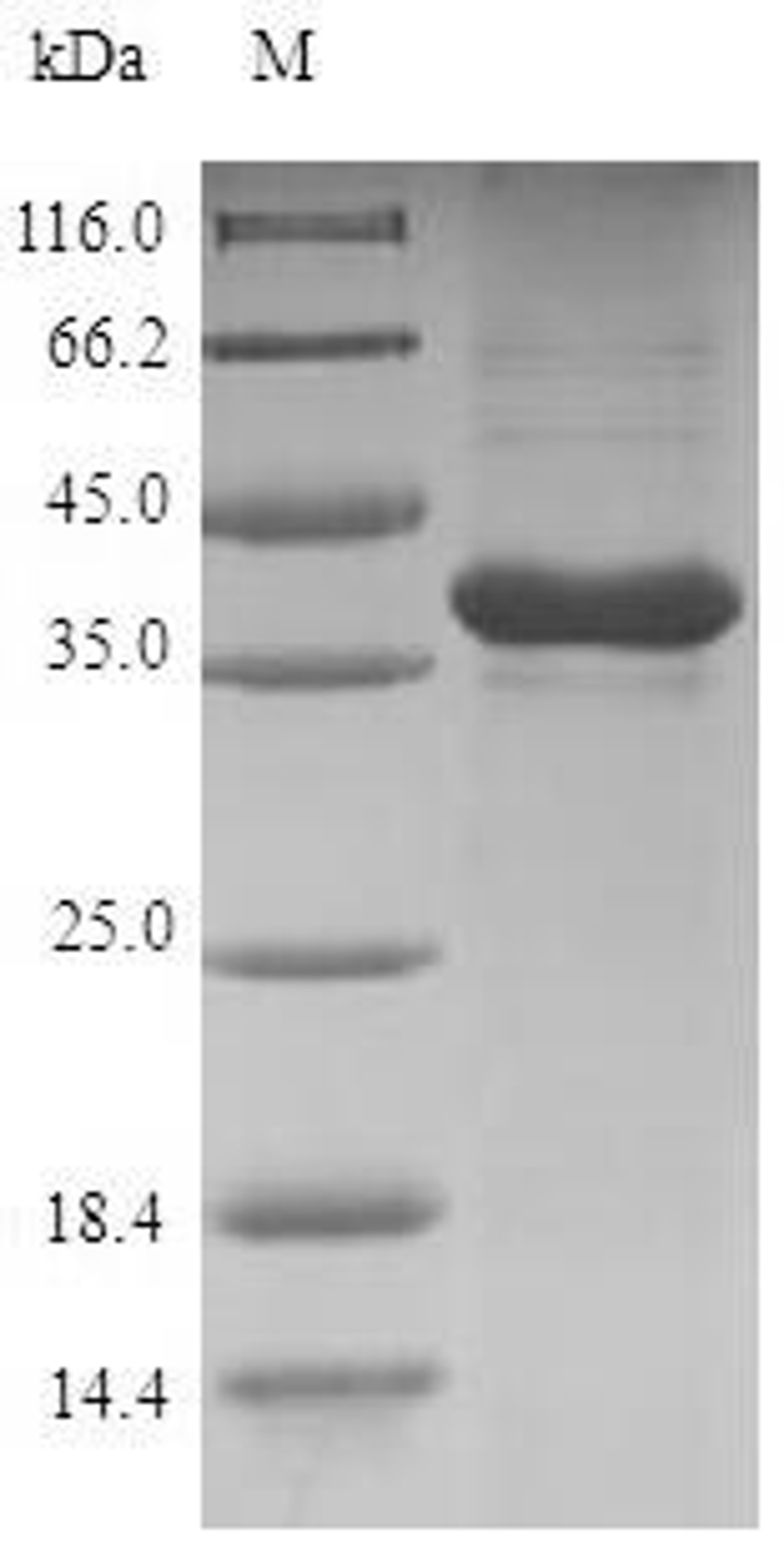 (Tris-Glycine gel) Discontinuous SDS-PAGE (reduced) with 5% enrichment gel and 15% separation gel.