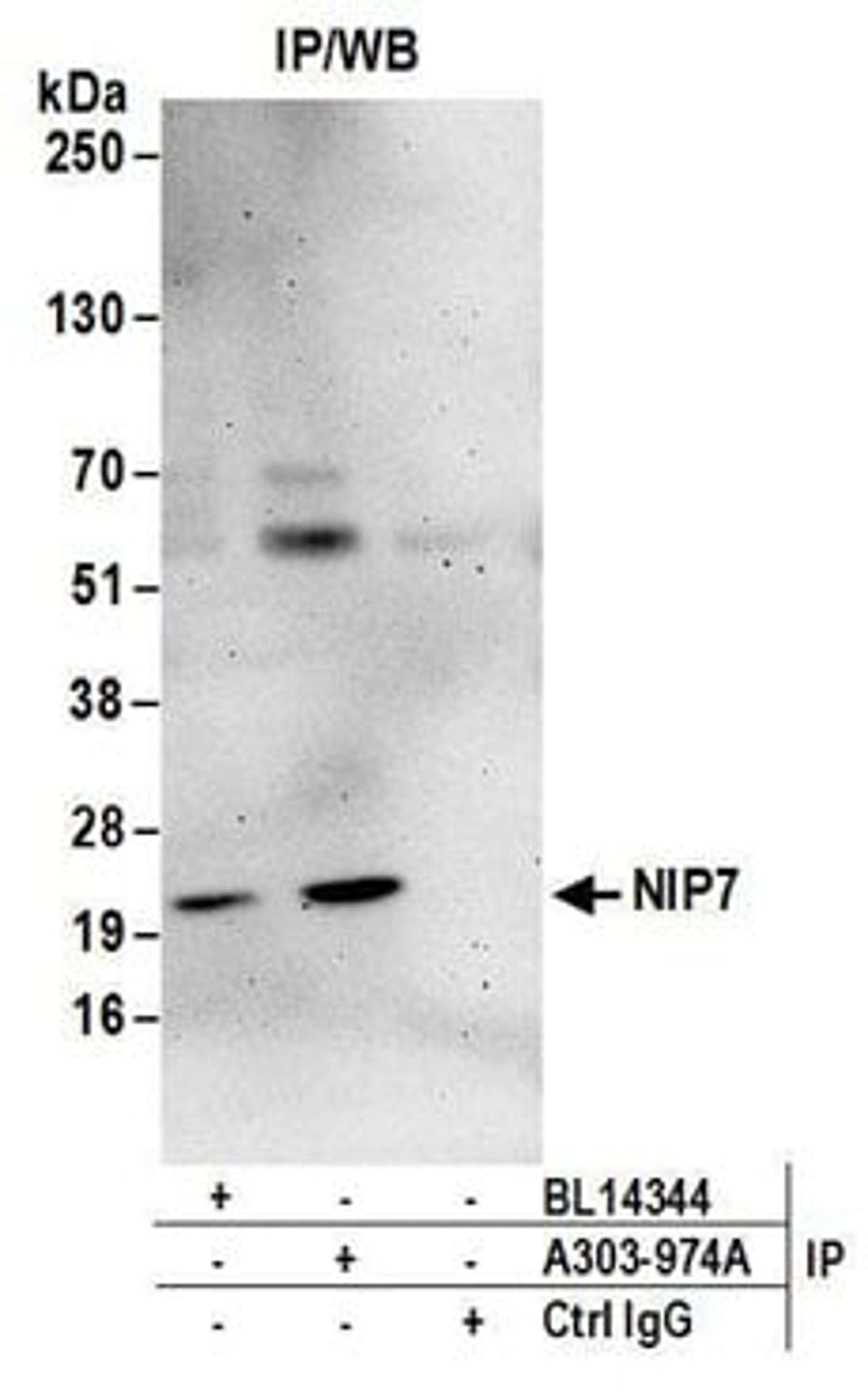 Detection of human NIP7 by western blot of immunoprecipitates.