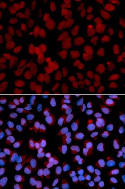 Immunofluorescence - TNFAIP3 antibody (A13637)