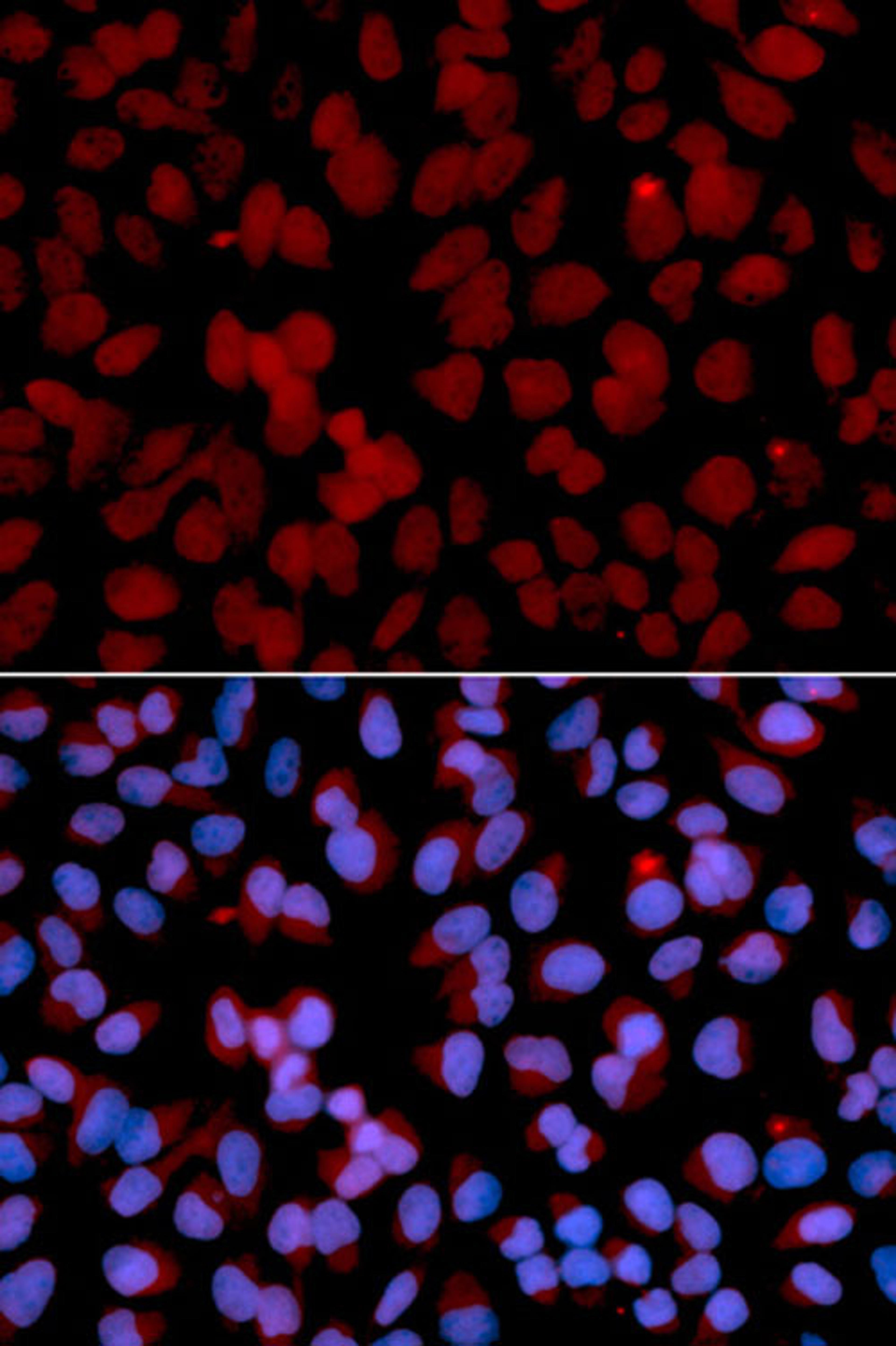 Immunofluorescence - TNFAIP3 antibody (A13637)