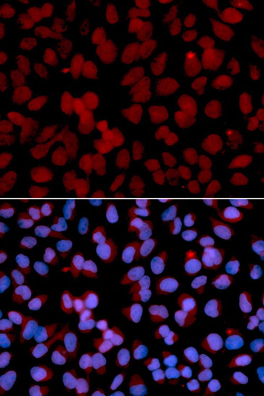 Immunofluorescence - TNFAIP3 antibody (A13637)