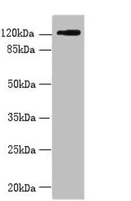 Western blot. All lanes: SLC4A8 antibody at 2µg/ml + Hela whole cell lysate. Secondary. Goat polyclonal to rabbit IgG at 1/10000 dilution. Predicted band size: 123, 121, 118, 112, 78, 84, 72 kDa. Observed band size: 123 kDa