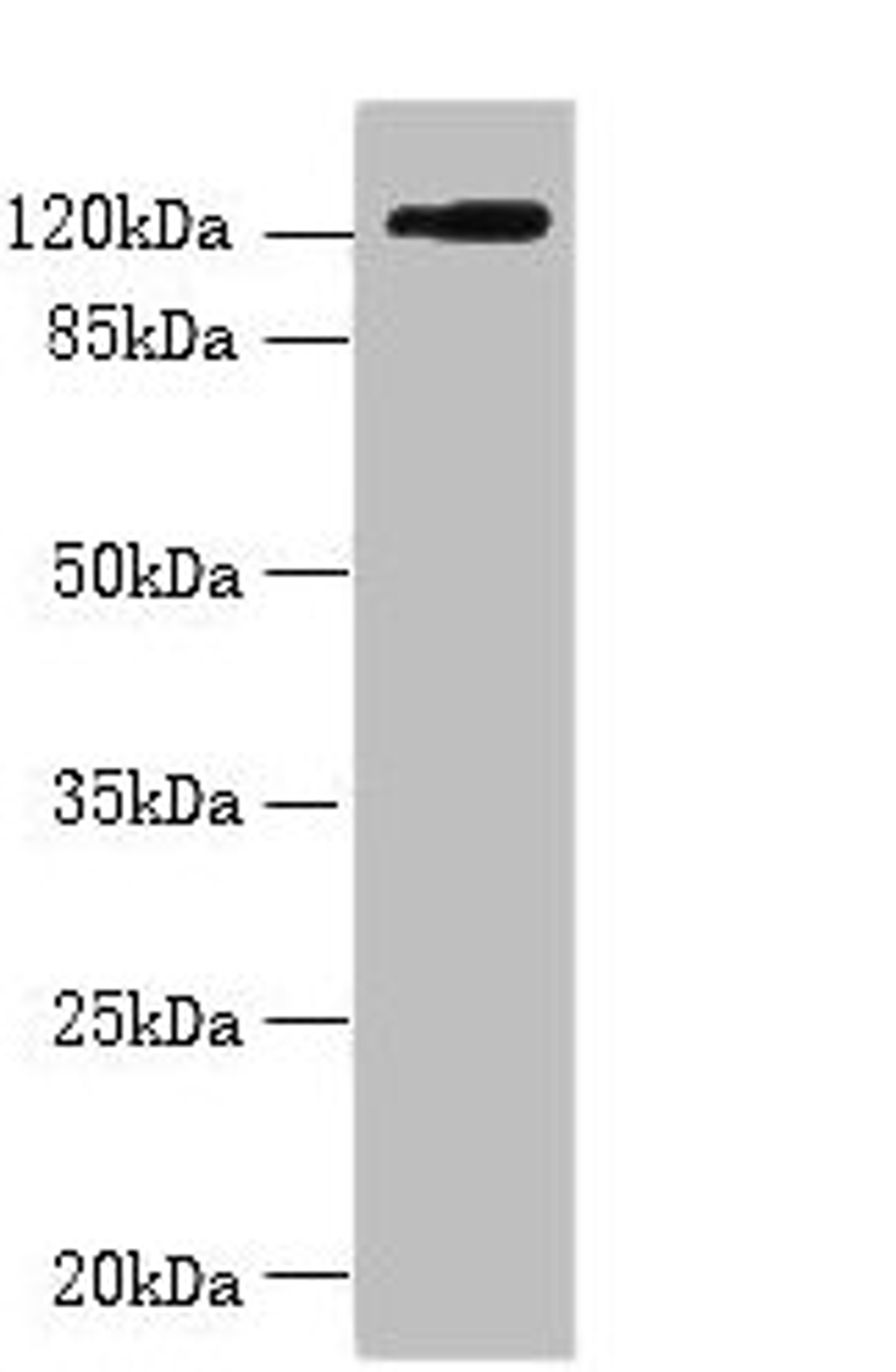 Western blot. All lanes: SLC4A8 antibody at 2µg/ml + Hela whole cell lysate. Secondary. Goat polyclonal to rabbit IgG at 1/10000 dilution. Predicted band size: 123, 121, 118, 112, 78, 84, 72 kDa. Observed band size: 123 kDa