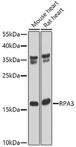 Western blot - RPA3 antibody (A6721)