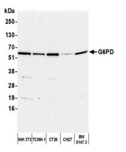 Detection of human G6PD by western blot.