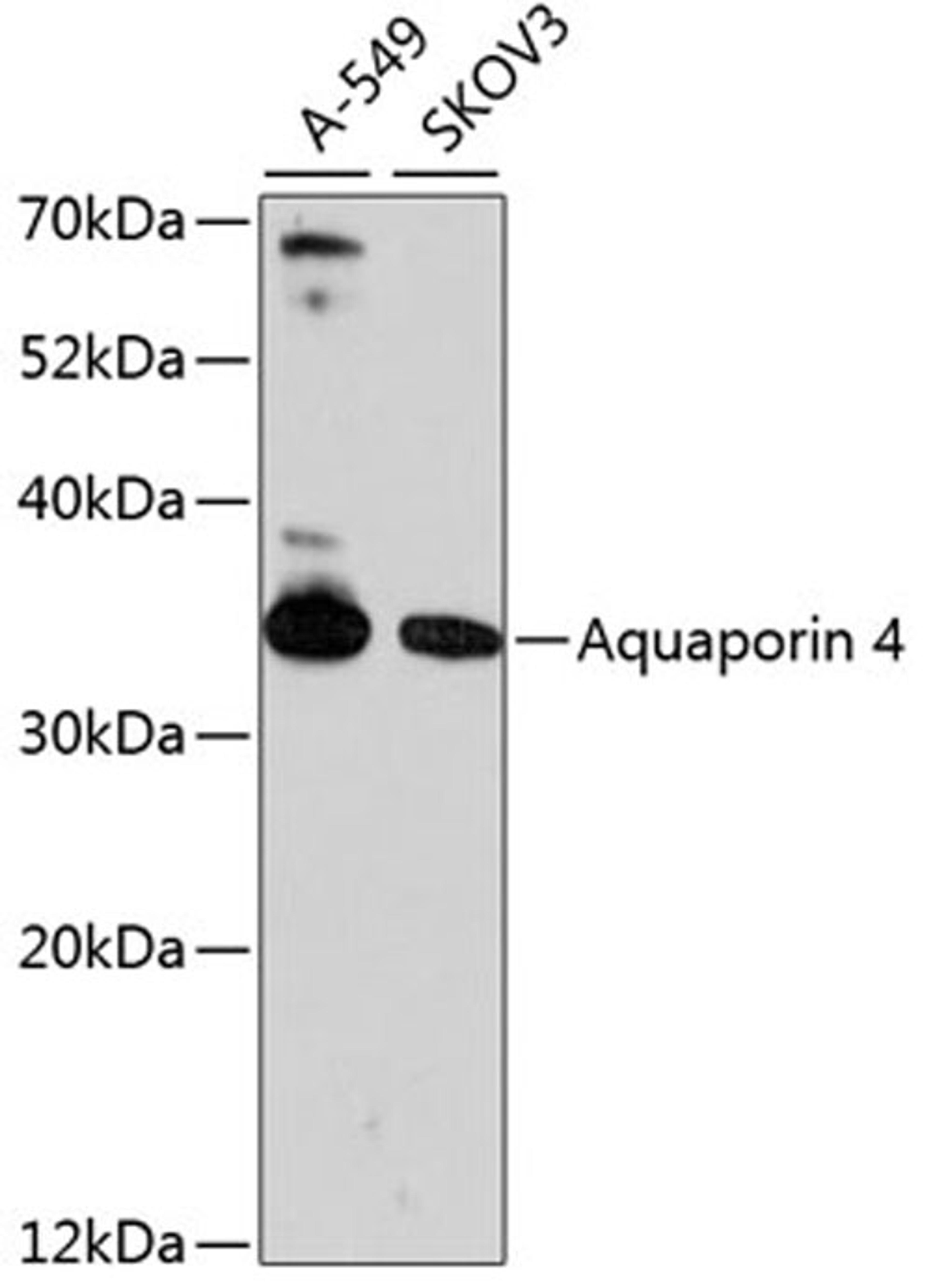 Western blot - Aquaporin 4 antibody (A13926)