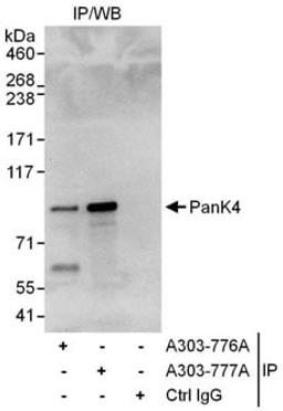 Detection of human PanK4 by western blot of immunoprecipitates.