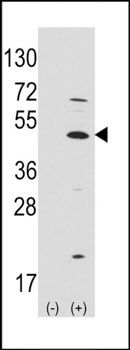 Western blot analysis of ATOH1 using rabbit polyclonal ATOH1 Antibody.293 cell lysates (2 ug/lane) either nontransfected (Lane 1) or transiently transfected with the ATOH1 gene (Lane 2).