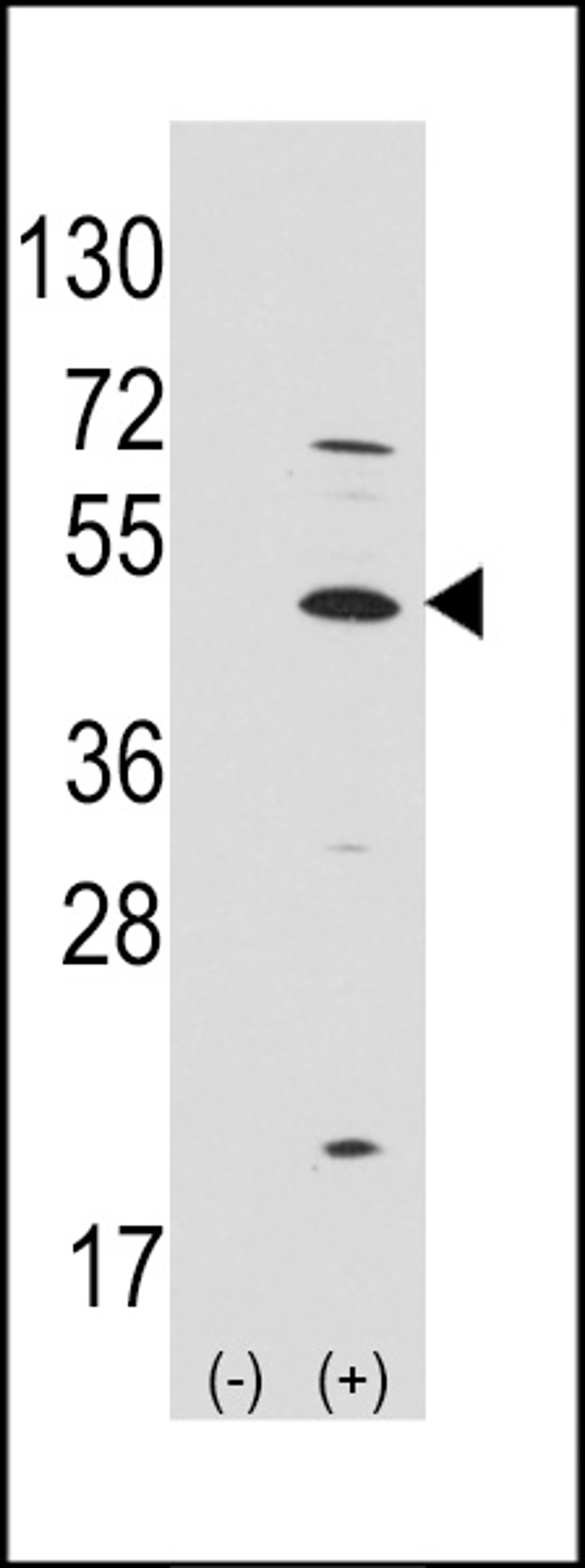 Western blot analysis of ATOH1 using rabbit polyclonal ATOH1 Antibody.293 cell lysates (2 ug/lane) either nontransfected (Lane 1) or transiently transfected with the ATOH1 gene (Lane 2).