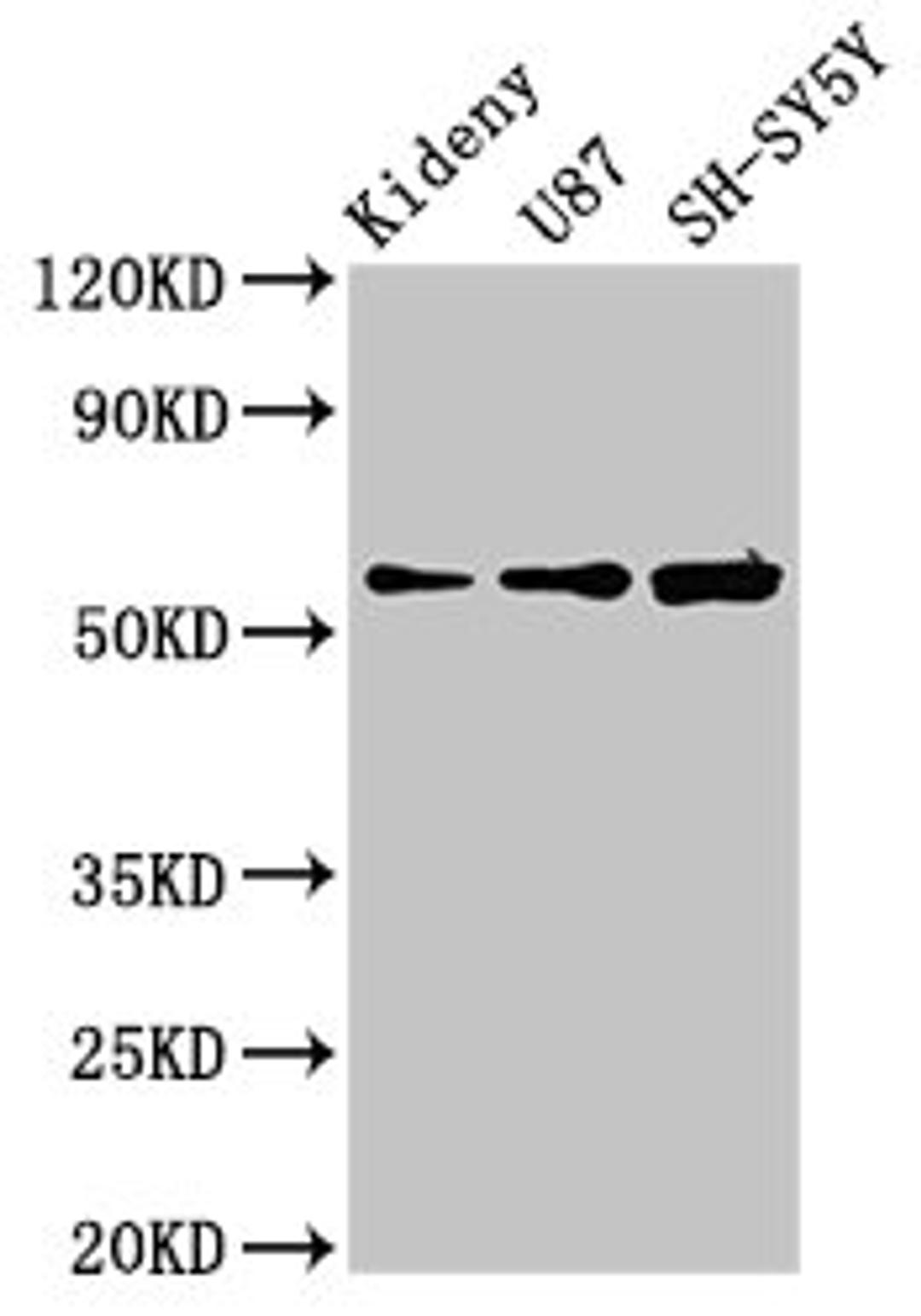 Western Blot. Positive WB detected in: Mouse kidney tissue, U87 whole cell lysate, SH-SY5Y whole cell lysate. All lanes: KCNAB1 antibody at 3.9µg/ml. Secondary. Goat polyclonal to rabbit IgG at 1/50000 dilution. Predicted band size: 47, 45, 46 kDa. Observed band size: 60 kDa