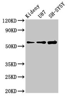 Western Blot. Positive WB detected in: Mouse kidney tissue, U87 whole cell lysate, SH-SY5Y whole cell lysate. All lanes: KCNAB1 antibody at 3.9µg/ml. Secondary. Goat polyclonal to rabbit IgG at 1/50000 dilution. Predicted band size: 47, 45, 46 kDa. Observed band size: 60 kDa