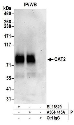 Detection of human CAT2 by western blot of immunoprecipitates.