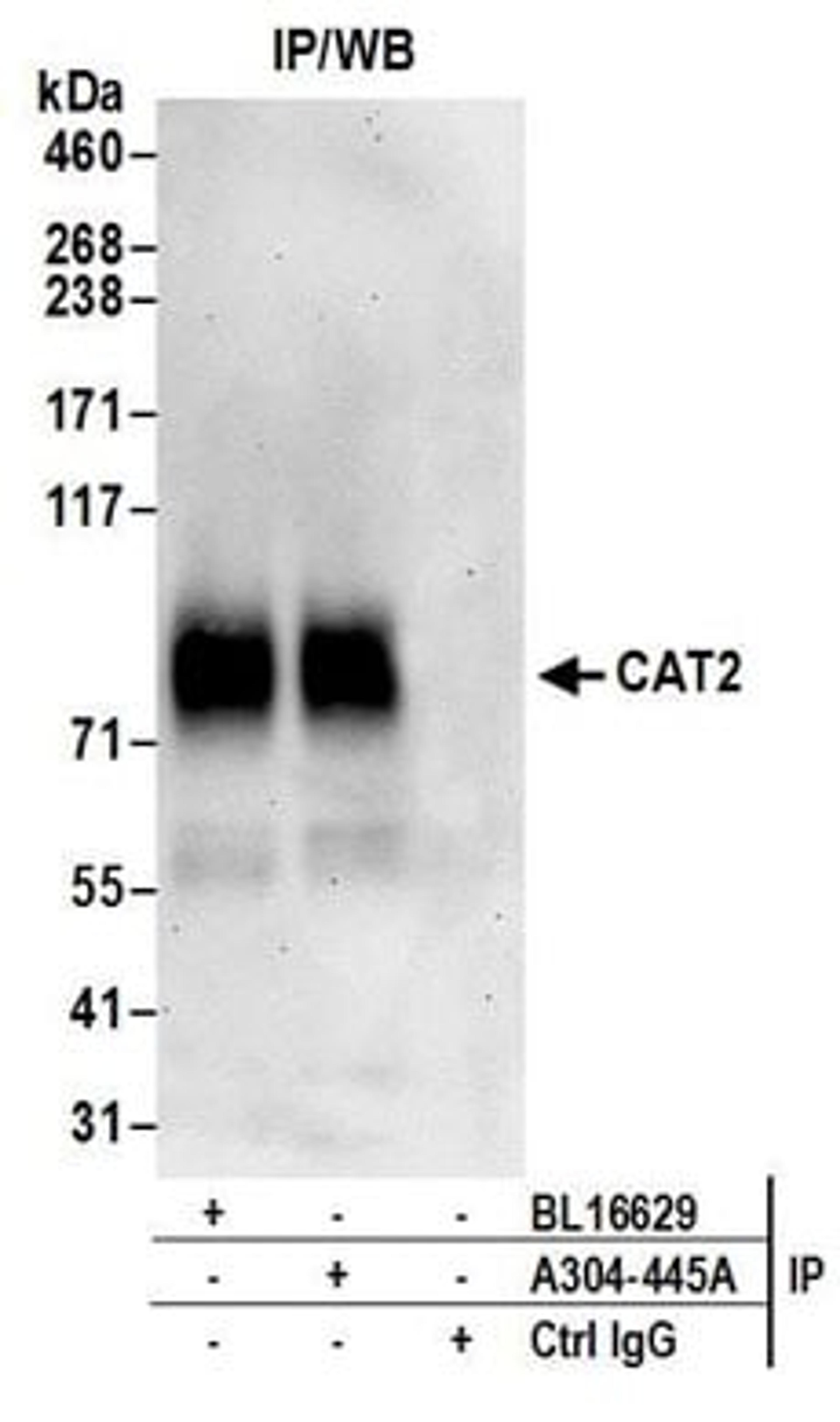 Detection of human CAT2 by western blot of immunoprecipitates.