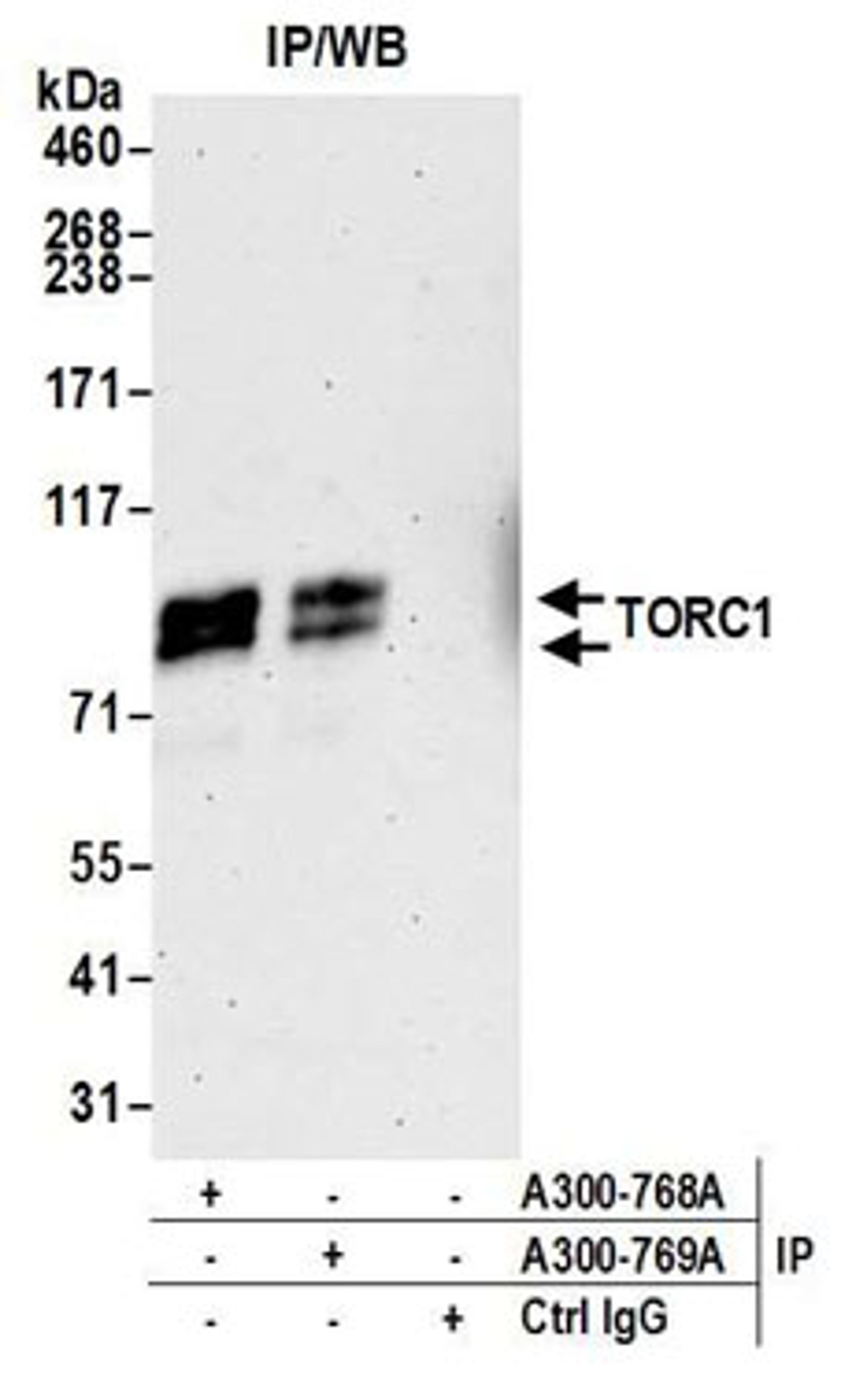 Detection of human TORC1 by western blot of immunoprecipitates.