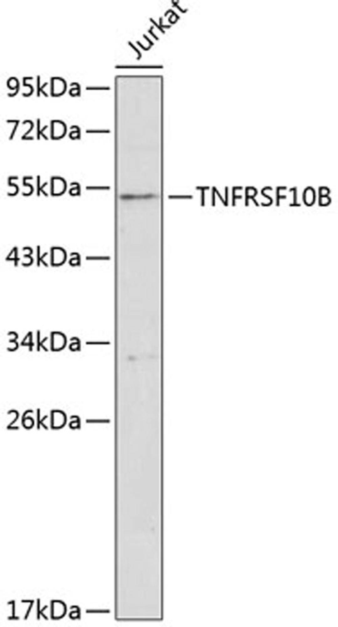 Western blot - TNFRSF10B antibody (A1236)