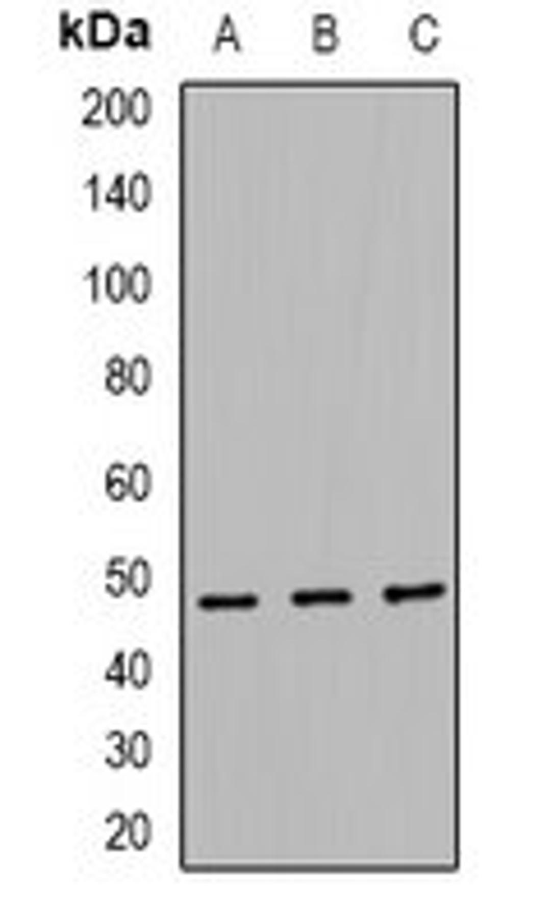 Western blot analysis of HEK293 (Lane1), RAW264.7 (Lane2), H9C2 (Lane3) whole cell lysates using TEAD2 antibody