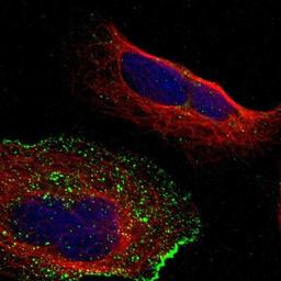 Immunocytochemistry/Immunofluorescence: GJB6 Antibody [NBP1-85377] Staining of human cell line U-2 OS shows positivity in plasma membrane & vesicles.