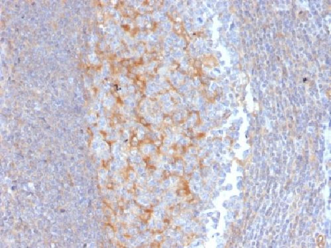 Immunohistochemical staining of human Tonsil tissue using ABCC1 antibody