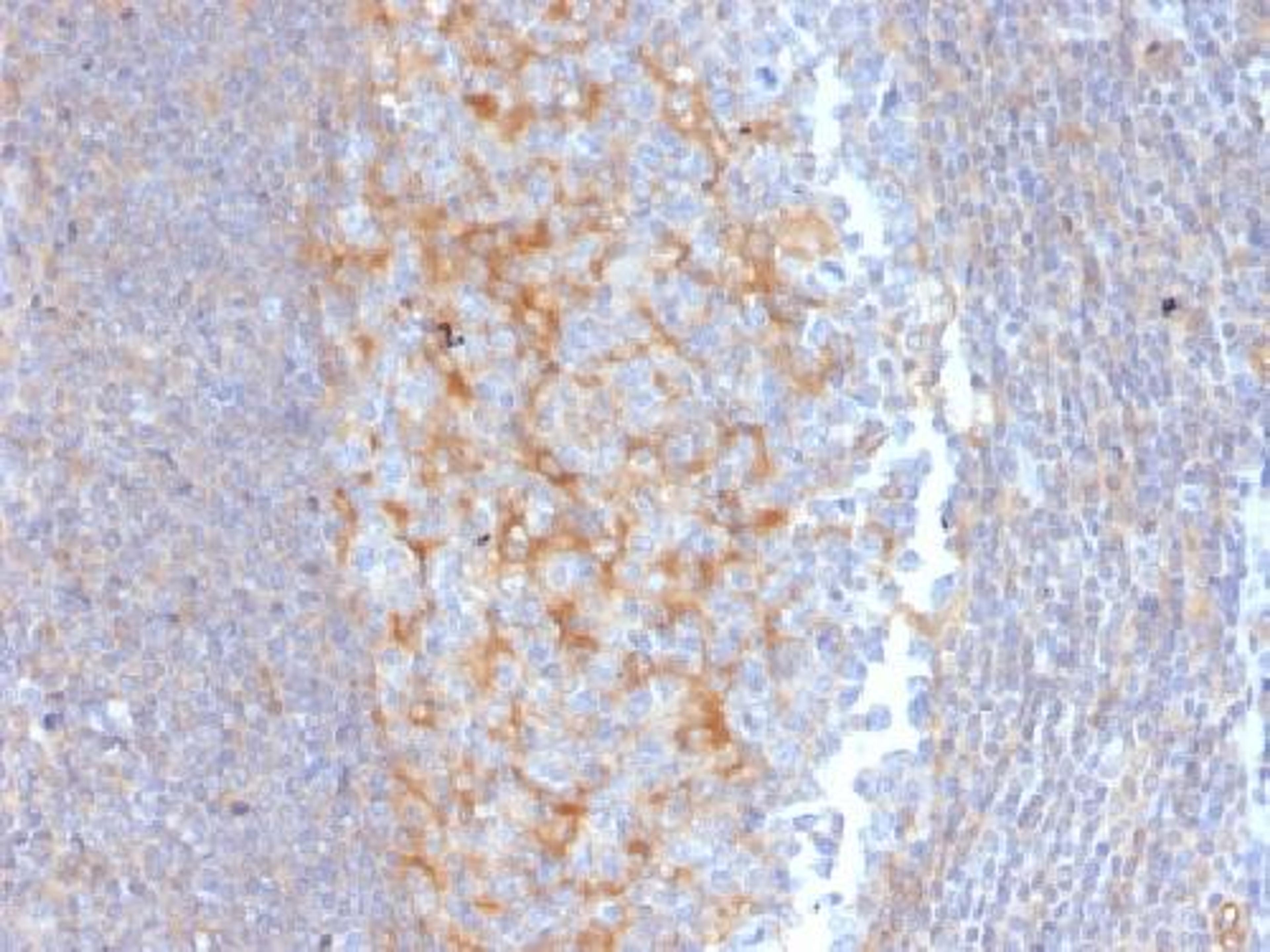 Immunohistochemical staining of human Tonsil tissue using ABCC1 antibody