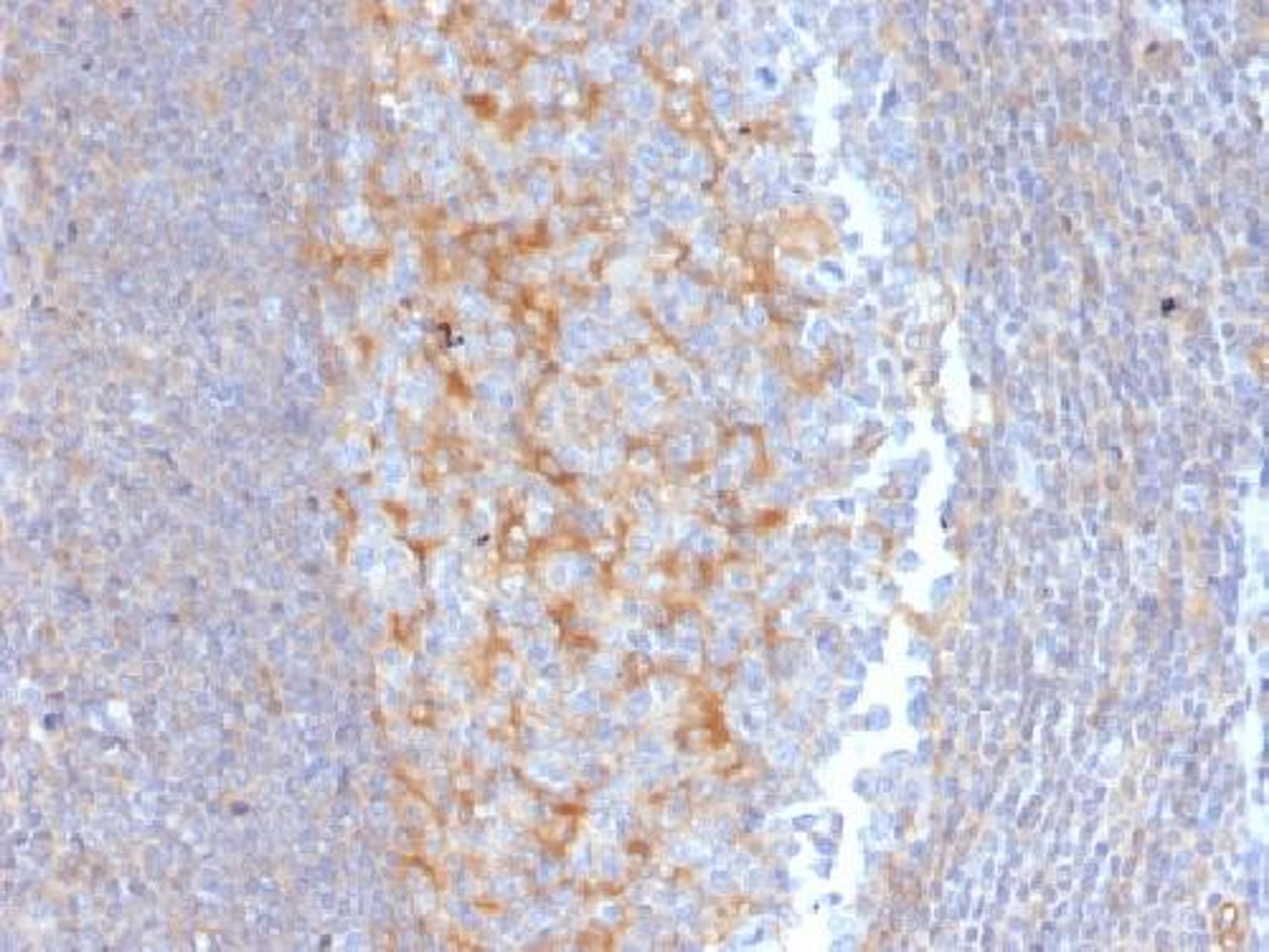 Immunohistochemical staining of human Tonsil tissue using ABCC1 antibody