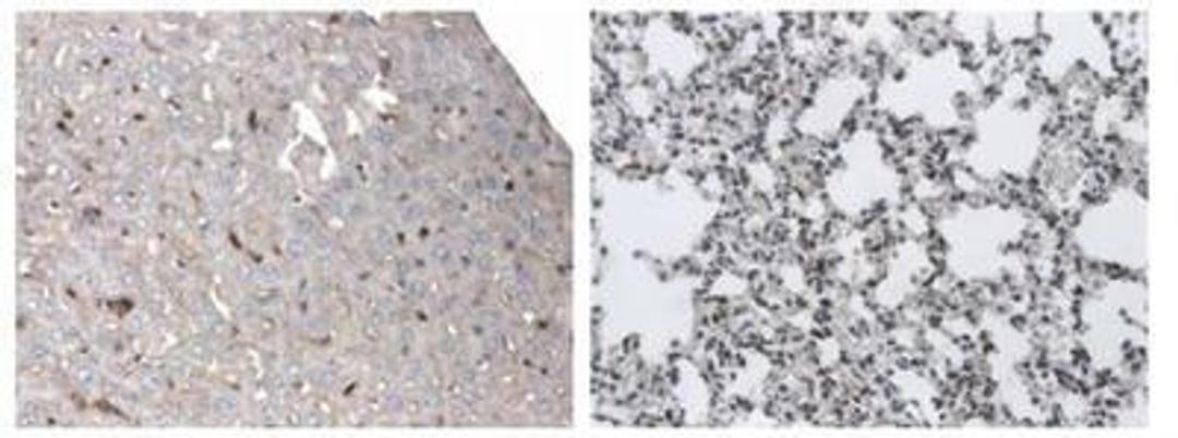 Immunohistochemistry-Paraffin: Dendritic Cell Marker Antibody (AP-MAB0801) [NB110-85474] - 4% PFA fixed and paraffin embedded mouse Liver and Lung  sections from LPS treated  mice was subjected to  staining (DAB) of DC marker.