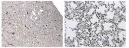 Immunohistochemistry-Paraffin: Dendritic Cell Marker Antibody (AP-MAB0801) [NB110-85474] - 4% PFA fixed and paraffin embedded mouse Liver and Lung  sections from LPS treated  mice was subjected to  staining (DAB) of DC marker.