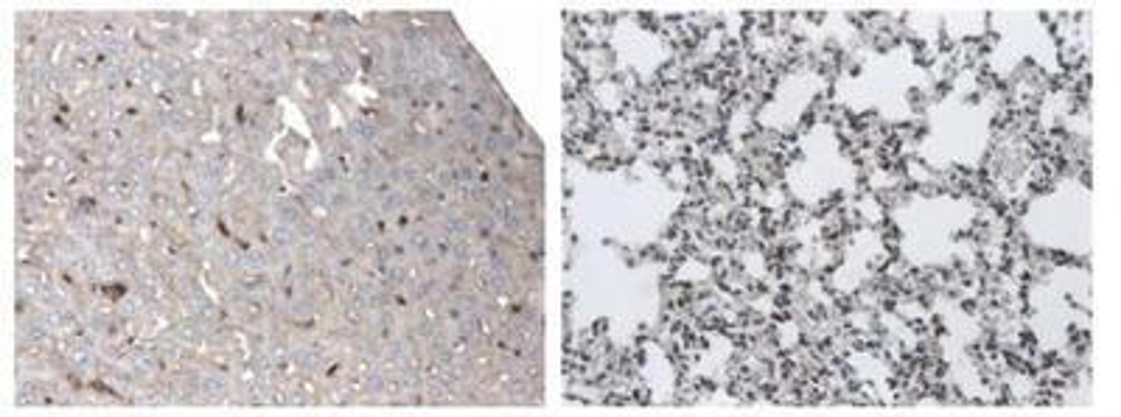 Immunohistochemistry-Paraffin: Dendritic Cell Marker Antibody (AP-MAB0801) [NB110-85474] - 4% PFA fixed and paraffin embedded mouse Liver and Lung  sections from LPS treated  mice was subjected to  staining (DAB) of DC marker.