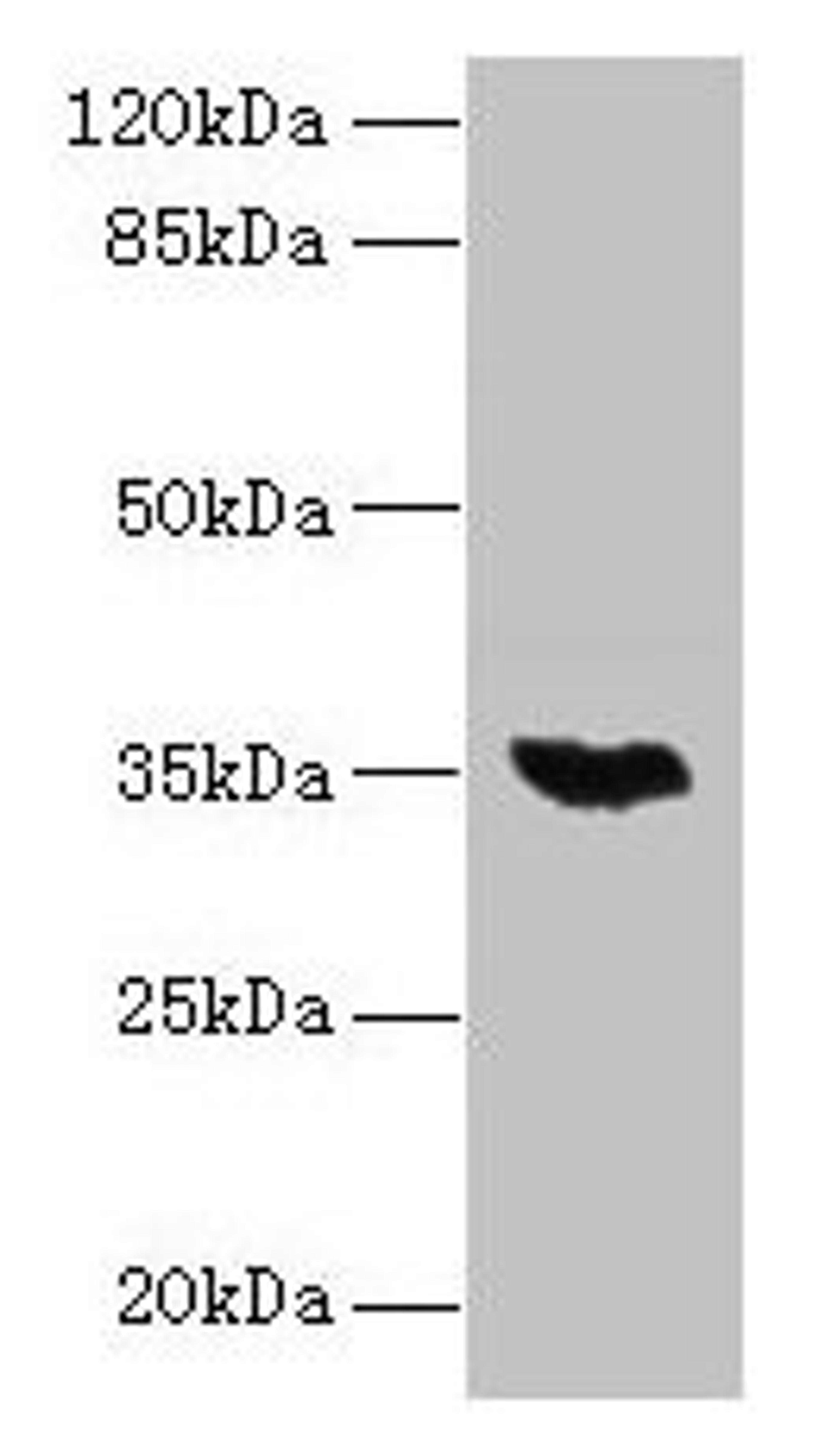 Western blot. All lanes: LYSMD3 antibody at 6µg/ml + Mouse heart tissue. Secondary. Goat polyclonal to rabbit IgG at 1/10000 dilution. Predicted band size: 35, 15, 18 kDa. Observed band size: 35 kDa