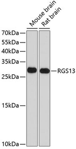 Western blot - RGS13 antibody (A10035)