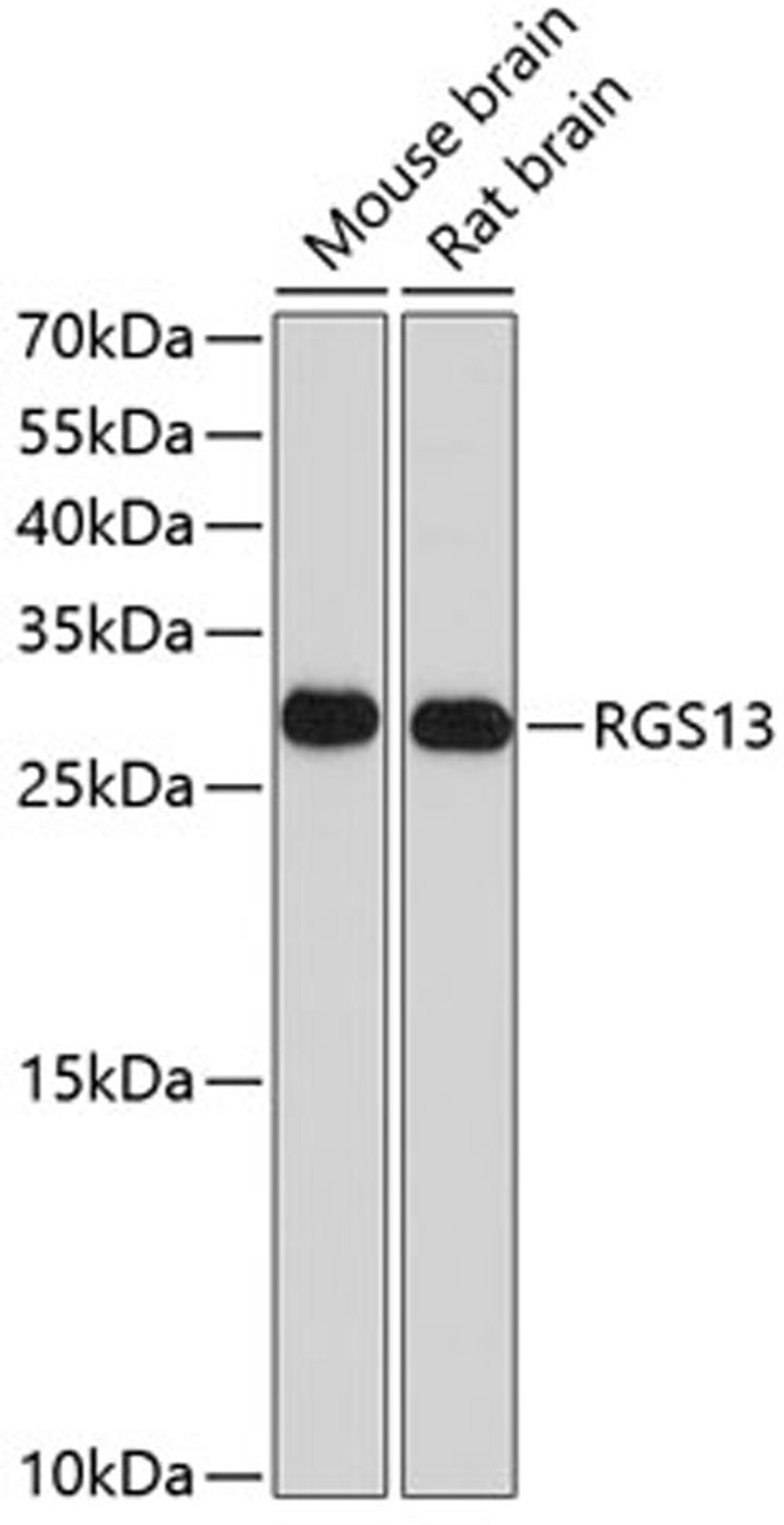 Western blot - RGS13 antibody (A10035)