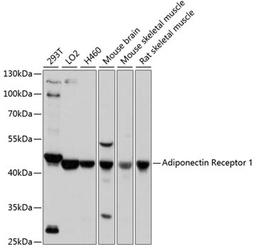 Western blot - Adiponectin Receptor 1 antibody (A16527)