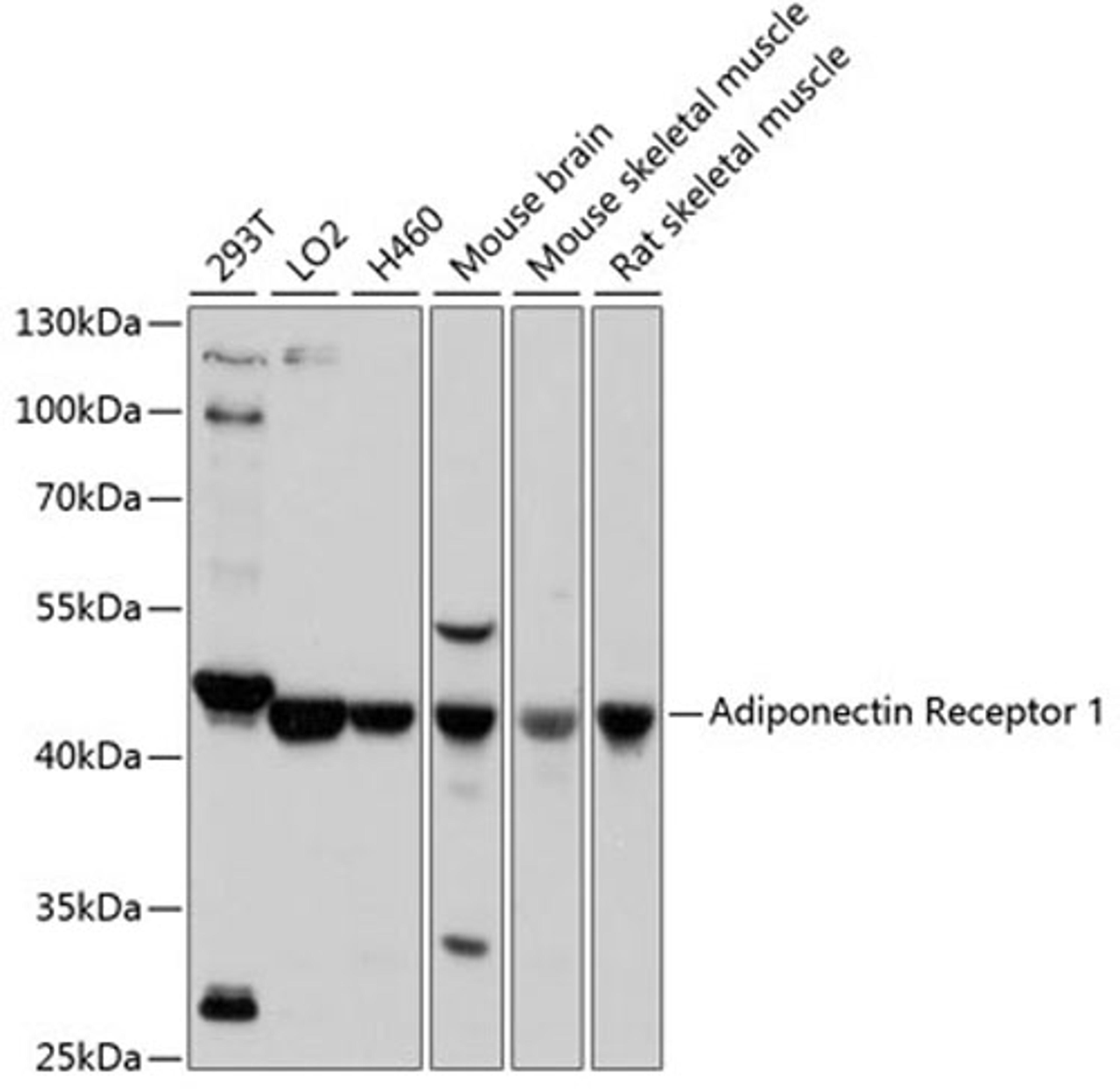 Western blot - Adiponectin Receptor 1 antibody (A16527)