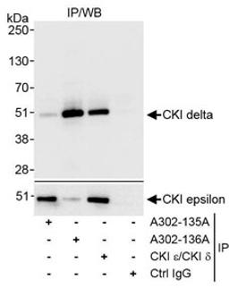 Detection of human CKI delta by western blot of immunoprecipitates.